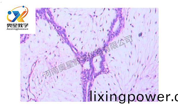 乳(ru)腺纖(xian)維(wei)腺(xian)癅(liu)