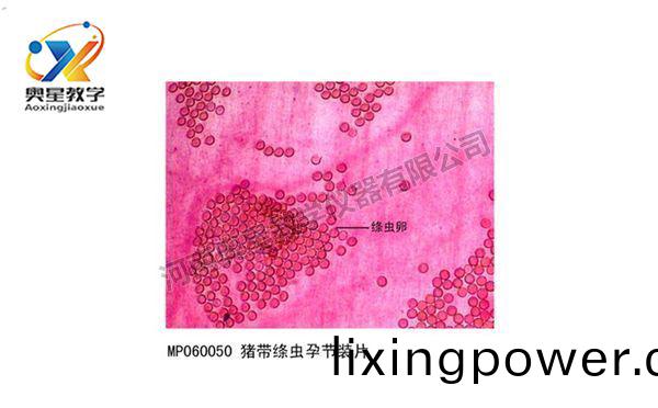 豬帶(dai)縧蟲孕(yun)節