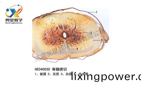 脊髓橫切