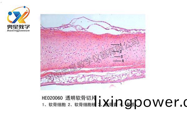 透明(ming)輭(ruan)骨