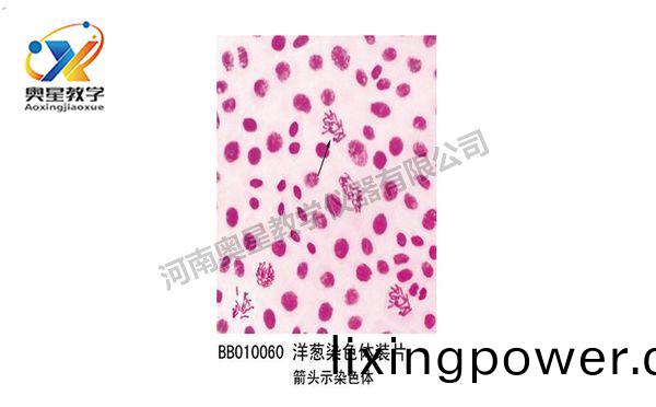 洋(yang)蔥染(ran)色體