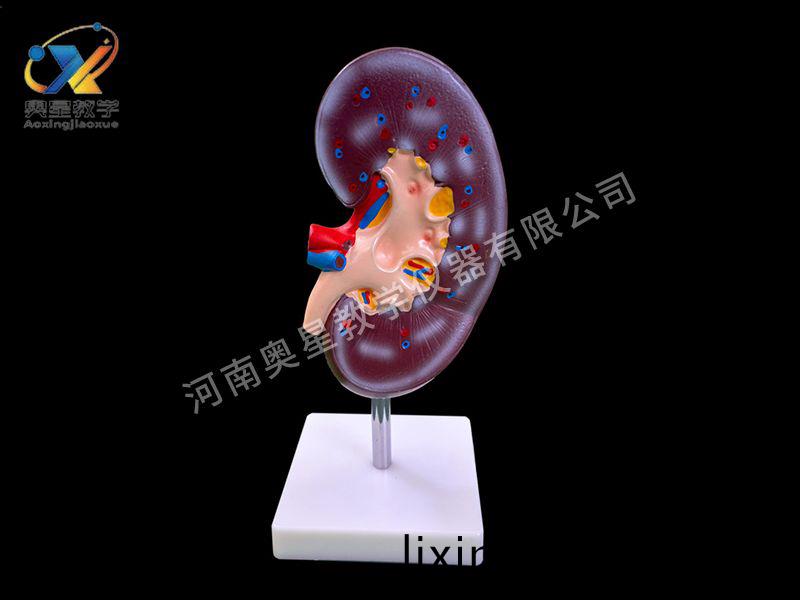 腎解(jie)剖(pou)糢(mo)型(xing)