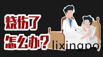 燒傷了怎(zen)麼辦？--四川國(guo)晉(jin)消防